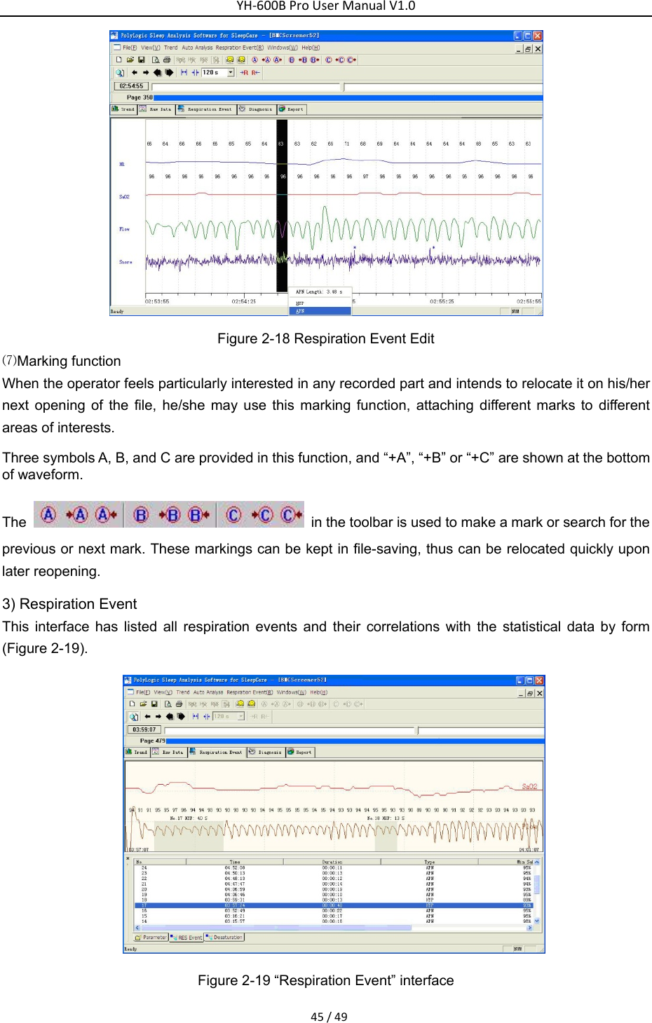 YH‐600BProUserManualV1.045/49 Figure 2-18 Respiration Event Edit ⑺Marking function When the operator feels particularly interested in any recorded part and intends to relocate it on his/her next opening of the file, he/she may use this marking function, attaching different marks to different areas of interests.   Three symbols A, B, and C are provided in this function, and &ldquo;+A&rdquo;, &ldquo;+B&rdquo; or &ldquo;+C&rdquo; are shown at the bottom of waveform. The    in the toolbar is used to make a mark or search for the previous or next mark. These markings can be kept in file-saving, thus can be relocated quickly upon later reopening.   3) Respiration Event This interface has listed all respiration events and their correlations with the statistical data by form (Figure 2-19).  Figure 2-19 &ldquo;Respiration Event&rdquo; interface 