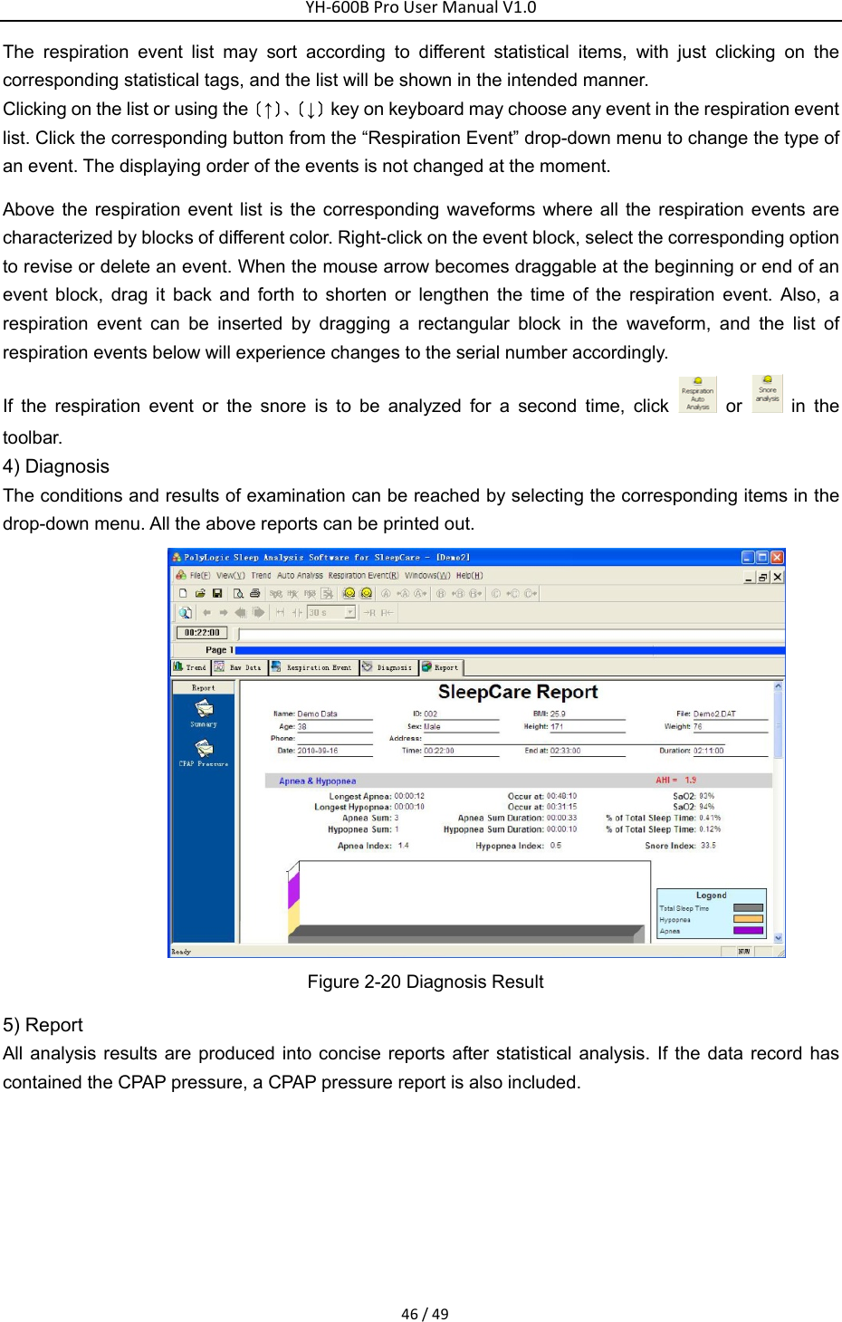 YH‐600BProUserManualV1.046/49The respiration event list may sort according to different statistical items, with just clicking on the corresponding statistical tags, and the list will be shown in the intended manner. Clicking on the list or using the〔&uarr;〕、〔&darr;〕key on keyboard may choose any event in the respiration event list. Click the corresponding button from the &ldquo;Respiration Event&rdquo; drop-down menu to change the type of an event. The displaying order of the events is not changed at the moment. Above the respiration event list is the corresponding waveforms where all the respiration events are characterized by blocks of different color. Right-click on the event block, select the corresponding option to revise or delete an event. When the mouse arrow becomes draggable at the beginning or end of an event block, drag it back and forth to shorten or lengthen the time of the respiration event. Also, a respiration event can be inserted by dragging a rectangular block in the waveform, and the list of respiration events below will experience changes to the serial number accordingly. If the respiration event or the snore is to be analyzed for a second time, click   or   in the toolbar. 4) Diagnosis   The conditions and results of examination can be reached by selecting the corresponding items in the drop-down menu. All the above reports can be printed out.    Figure 2-20 Diagnosis Result 5) Report All analysis results are produced into concise reports after statistical analysis. If the data record has contained the CPAP pressure, a CPAP pressure report is also included. 