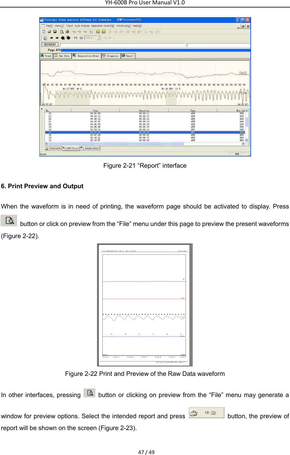 YH‐600BProUserManualV1.047/49 Figure 2-21 &ldquo;Report&rdquo; interface 6. Print Preview and Output When the waveform is in need of printing, the waveform page should be activated to display. Press   button or click on preview from the &ldquo;File&rdquo; menu under this page to preview the present waveforms (Figure 2-22).  Figure 2-22 Print and Preview of the Raw Data waveform In other interfaces, pressing    button or clicking on preview from the &ldquo;File&rdquo; menu may generate a window for preview options. Select the intended report and press    button, the preview of report will be shown on the screen (Figure 2-23).   