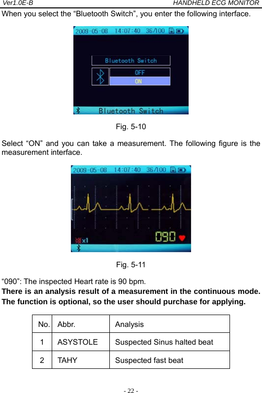 Ver1.0E-B                                          HANDHELD ECG MONITOR  - 22 -When you select the &ldquo;Bluetooth Switch&rdquo;, you enter the following interface.  Fig. 5-10 Select &ldquo;ON&rdquo; and you can take a measurement. The following figure is the measurement interface.  Fig. 5-11 &ldquo;090&rdquo;: The inspected Heart rate is 90 bpm. There is an analysis result of a measurement in the continuous mode. The function is optional, so the user should purchase for applying. No. Abbr.  Analysis  1  ASYSTOLE  Suspected Sinus halted beat 2 TAHY  Suspected fast beat 