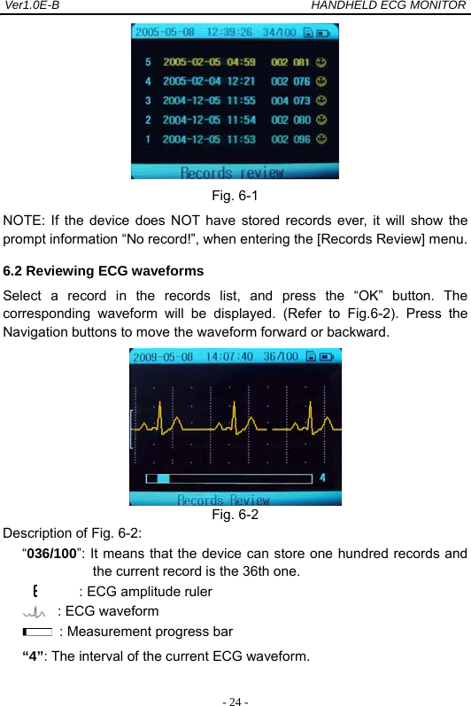 Ver1.0E-B                                          HANDHELD ECG MONITOR  - 24 - Fig. 6-1 NOTE: If the device does NOT have stored records ever, it will show the prompt information &ldquo;No record!&rdquo;, when entering the [Records Review] menu. 6.2 Reviewing ECG waveforms   Select a record in the records list, and press the &ldquo;OK&rdquo; button. The corresponding waveform will be displayed. (Refer to Fig.6-2). Press the Navigation buttons to move the waveform forward or backward.    Fig. 6-2 Description of Fig. 6-2: &ldquo;036/100&rdquo;: It means that the device can store one hundred records and the current record is the 36th one. : ECG amplitude ruler       : ECG waveform    : Measurement progress bar &ldquo;4&rdquo;: The interval of the current ECG waveform. 
