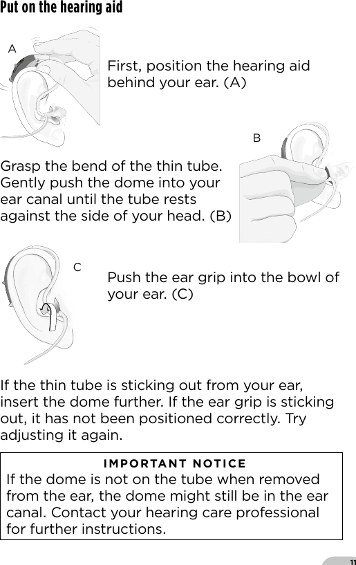 11Bernafon nano BTE IFUVR_ILU_InsertingNanoBTEspira3_BW_HIBernafon nano BTE IFUVR_ILU_InsertingNanoBTEspira2_BW_HIBernafon nano BTE IFUVR_ILU_InsertingNanoBTEspira1_BW_HIPut on the hearing aidIf the thin tube is sticking out from your ear insert the dome further If the ear grip is sticking out it has not been positioned correctly Try adjusting it again   IMPORTANT NOTICE  If the dome is not on the tube when removed from the ear the dome might still be in the ear canal Contact your hearing care professional for further instructionsFirst position the hearing aid behind your ear (A)Push the ear grip into the bowl of your ear (C)Grasp the bend of the thin tube Gently push the dome into your ear canal until the tube rests against the side of your head (B)ABC