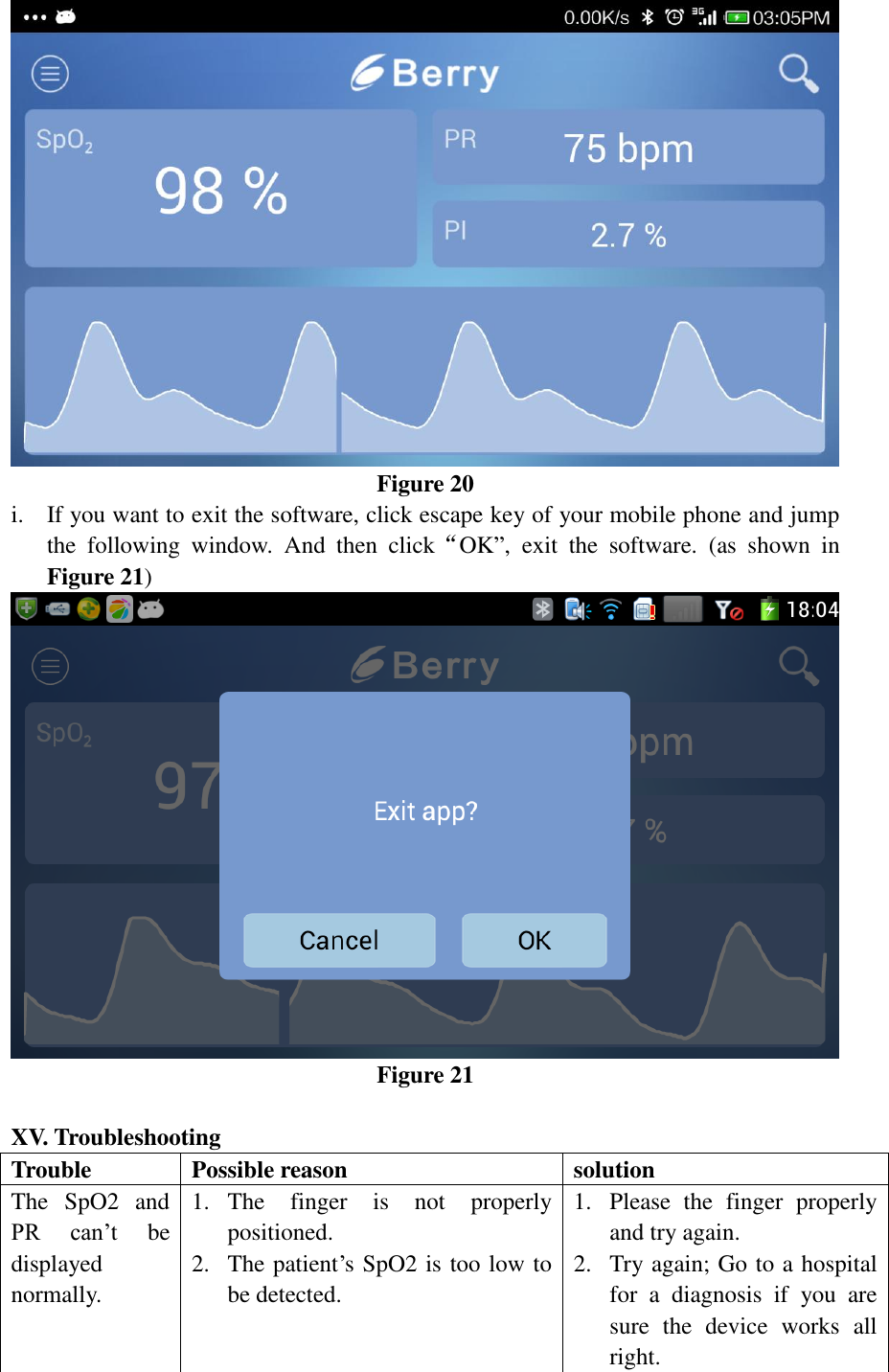  Figure 20 i. If you want to exit the software, click escape key of your mobile phone and jump the  following  window.  And  then  click“OK”,  exit  the  software.  (as  shown  in Figure 21)  Figure 21  XV. Troubleshooting Trouble Possible reason solution The  SpO2  and PR  can’t  be displayed normally. 1. The  finger  is  not  properly positioned. 2. The patient’s SpO2 is too low to be detected. 1. Please  the  finger  properly and try again. 2. Try again; Go to a hospital for  a  diagnosis  if  you  are sure  the  device  works  all right. 