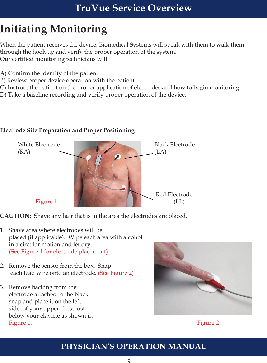 9Initiating Monitoring When the patient receives the device, Biomedical Systems will speak with them to walk themthrough the hook up and verify the proper operation of the system. Our certied monitoring technicians will:A) Conrm the identity of the patient.B) Review proper device operation with the patient. C) Instruct the patient on the proper application of electrodes and how to begin monitoring.D) Take a baseline recording and verify proper operation of the device.Electrode Site Preparation and Proper Positioning  White Electrode                  Black Electrode  (RA)                      (LA)                         Red Electrode  Figure 1                     (LL)CAUTION:  Shave any hair that is in the area the electrodes are placed. 1.  Shave area where electrodes will be        placed (if applicable).  Wipe each area with alcohol    in a circular motion and let dry.   (See Figure 1 for electrode placement) 2.   Remove the sensor from the box.  Snap       each lead wire onto an electrode. (See Figure 2)3.   Remove backing from the       electrode attached to the black      snap and place it on the left      side  of your upper chest just       below your clavicle as shown in       Figure 1.                     Figure 2PHYSICIAN’S OPERATION MANUALTruVue Service Overview