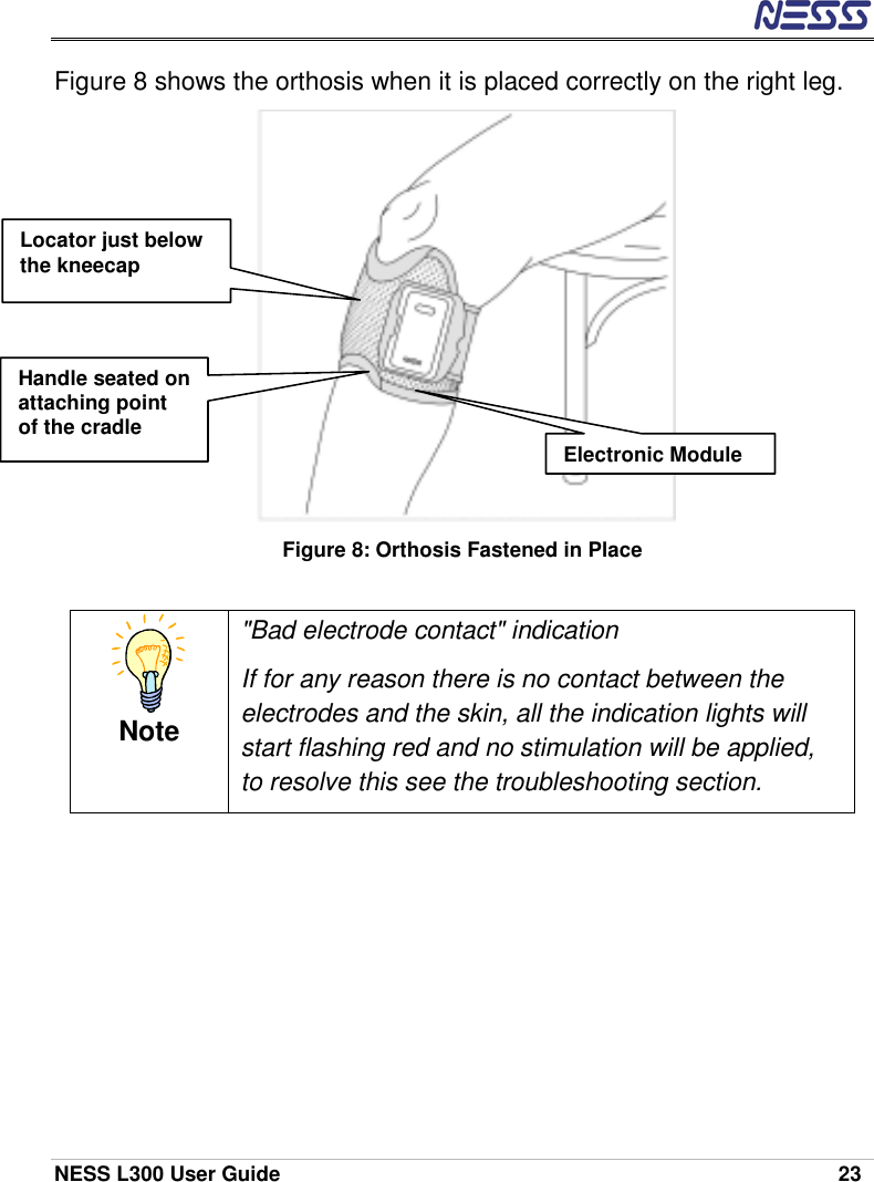  NESS L300 User Guide    23 Figure 8 shows the orthosis when it is placed correctly on the right leg.  Figure 8: Orthosis Fastened in Place  Note &quot;Bad electrode contact&quot; indication If for any reason there is no contact between the electrodes and the skin, all the indication lights will start flashing red and no stimulation will be applied, to resolve this see the troubleshooting section. Locator just below the kneecap Handle seated on attaching point of the cradle Electronic Module 