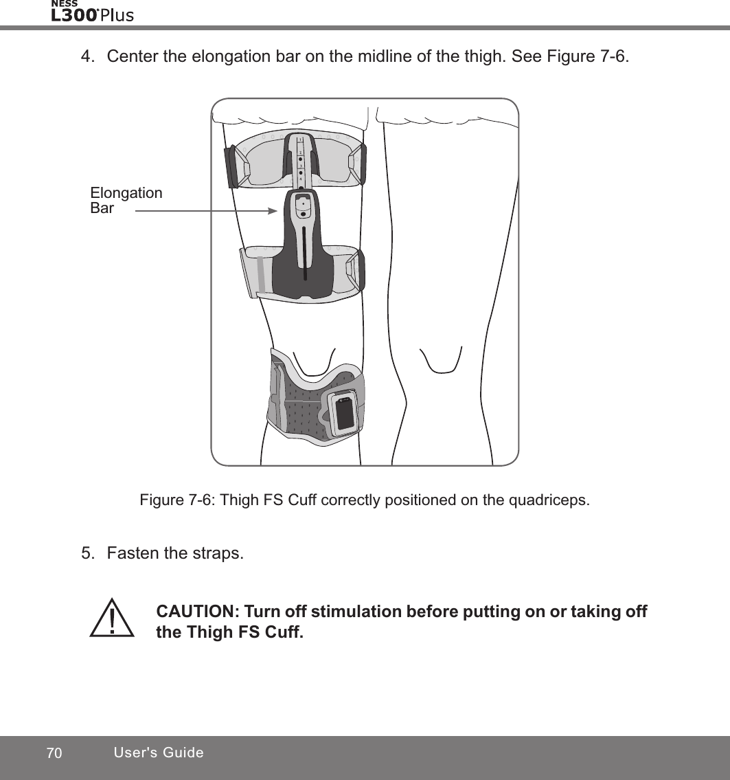 70 User&apos;s GuideFigure 7-6: Thigh FS Cuff correctly positioned on the quadriceps.4.  Center the elongation bar on the midline of the thigh. See Figure 7-6.Elongation BarCAUTION: Turn off stimulation before putting on or taking off the Thigh FS Cuff.5.  Fasten the straps.