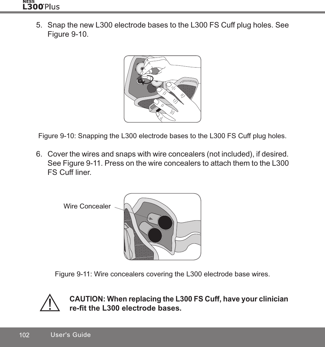 102 User&apos;s GuideFigure 9-10: Snapping the L300 electrode bases to the L300 FS Cuff plug holes.Figure 9-11: Wire concealers covering the L300 electrode base wires.CAUTION: When replacing the L300 FS Cuff, have your clinician re-ﬁt the L300 electrode bases.5.  Snap the new L300 electrode bases to the L300 FS Cuff plug holes. See Figure 9-10. 6. Cover the wires and snaps with wire concealers (not included), if desired. See Figure 9-11. Press on the wire concealers to attach them to the L300 FS Cuff liner.Wire Concealer