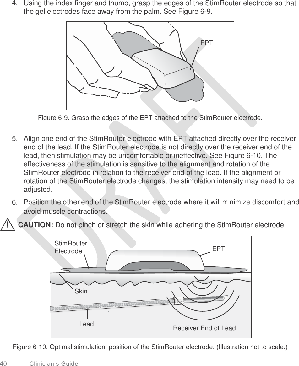                                                                                                                                                                               4. Using the index finger and thumb, grasp the edges of the StimRouter electrode so that the gel electrodes face away from the palm. See Figure 6-9. Figure 6-9. Grasp the edges of the EPT attached to the StimRouter electrode. 5. Align one end of the StimRouter electrode with EPT attached directly over the receiver end of the lead. If the StimRouter electrode is not directly over the receiver end of the lead, then stimulation may be uncomfortable or ineffective. See Figure 6-10. The effectiveness of the stimulation is sensitive to the alignment and rotation of the StimRouter electrode in relation to the receiver end of the lead. If the alignment or rotation of the StimRouter electrode changes, the stimulation intensity may need to be adjusted.  Position the other end of the StimRouter electrode where it will minimize discomfort and avoid muscle contractions. 6. CAUTION: Do not pinch or stretch the skin while adhering the StimRouter electrode. EPT Electrode Figure 6-10. Optimal stimulation, position of the StimRouter electrode. (Illustration not to scale.) 40 Clinician’s Guide StimRouter    Skin     Lead Receiver End of Lead    EPT  