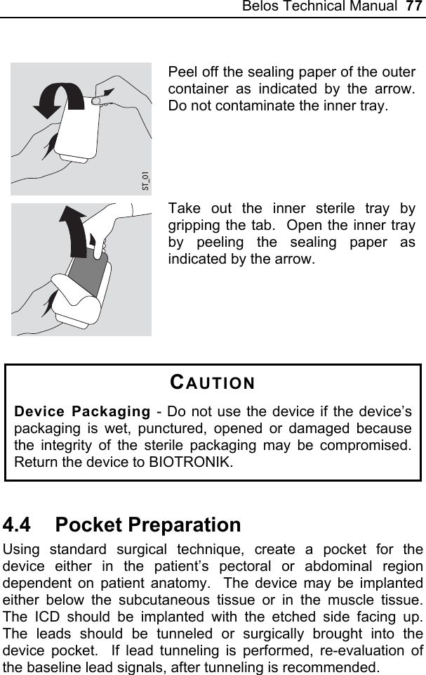 Belos Technical Manual  77  ST_01 Peel off the sealing paper of the outer container as indicated by the arrow.  Do not contaminate the inner tray.    Take out the inner sterile tray by gripping the tab.  Open the inner tray by peeling the sealing paper as indicated by the arrow.   CAUTION Device Packaging - Do not use the device if the device’s packaging is wet, punctured, opened or damaged because the integrity of the sterile packaging may be compromised.  Return the device to BIOTRONIK.  4.4 Pocket Preparation Using standard surgical technique, create a pocket for the device either in the patient’s pectoral or abdominal region dependent on patient anatomy.  The device may be implanted either below the subcutaneous tissue or in the muscle tissue.  The ICD should be implanted with the etched side facing up.  The leads should be tunneled or surgically brought into the device pocket.  If lead tunneling is performed, re-evaluation of the baseline lead signals, after tunneling is recommended.  