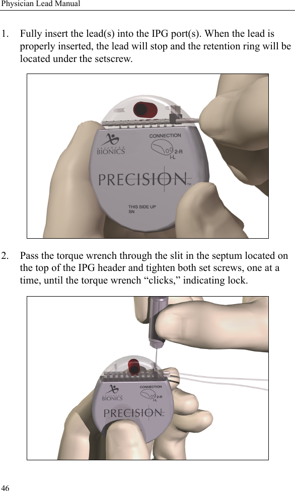 46Physician Lead Manual1. Fully insert the lead(s) into the IPG port(s). When the lead is properly inserted, the lead will stop and the retention ring will be located under the setscrew. 2. Pass the torque wrench through the slit in the septum located on the top of the IPG header and tighten both set screws, one at a time, until the torque wrench “clicks,” indicating lock. 