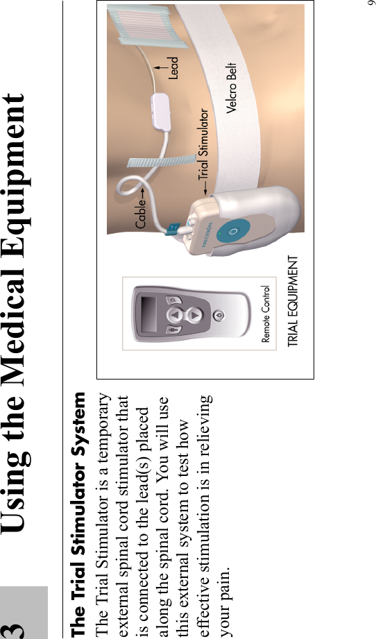 93 Using the Medical Equipment The Trial Stimulator SystemThe Trial Stimulator is a temporary external spinal cord stimulator that is connected to the lead(s) placed along the spinal cord. You will use this external system to test how effective stimulation is in relieving your pain.