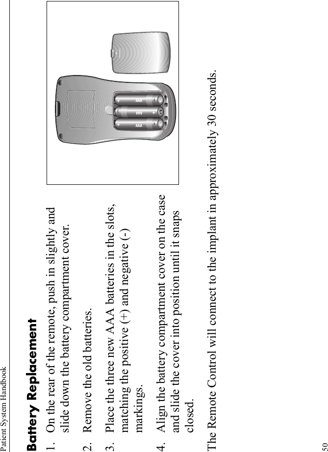 Patient System Handbook50Battery Replacement1. On the rear of the remote, push in slightly and slide down the battery compartment cover.2. Remove the old batteries.3. Place the three new AAA batteries in the slots, matching the positive (+) and negative (-) markings.4. Align the battery compartment cover on the case and slide the cover into position until it snaps closed.The Remote Control will connect to the implant in approximately 30 seconds.