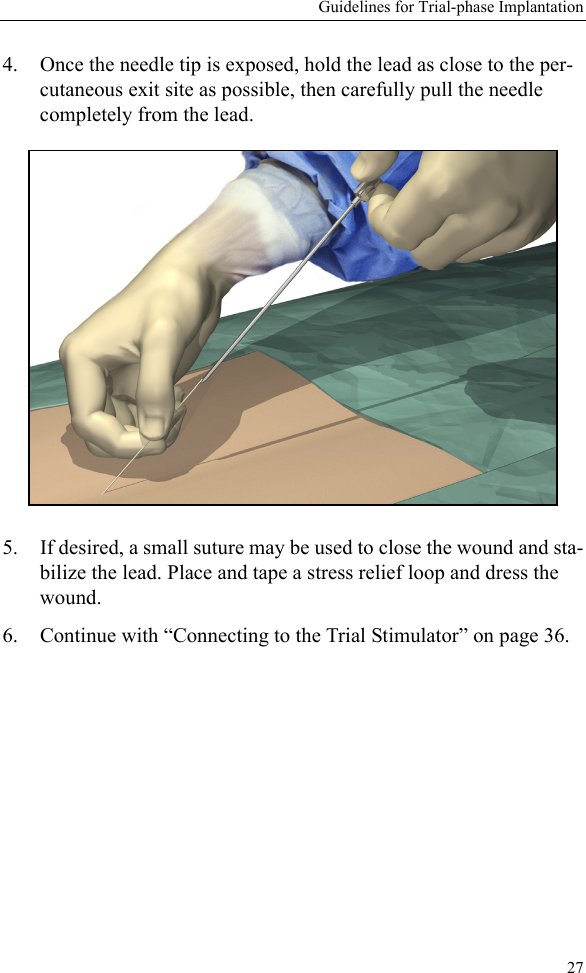Guidelines for Trial-phase Implantation274. Once the needle tip is exposed, hold the lead as close to the per-cutaneous exit site as possible, then carefully pull the needle completely from the lead.5. If desired, a small suture may be used to close the wound and sta-bilize the lead. Place and tape a stress relief loop and dress the wound.6. Continue with “Connecting to the Trial Stimulator” on page 36.