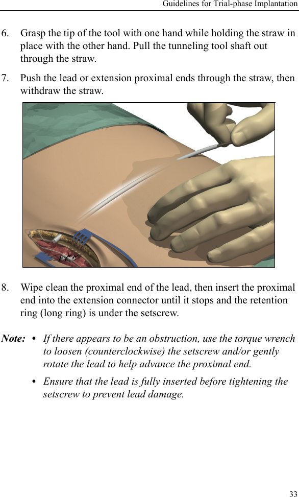 Guidelines for Trial-phase Implantation336. Grasp the tip of the tool with one hand while holding the straw in place with the other hand. Pull the tunneling tool shaft out through the straw.7. Push the lead or extension proximal ends through the straw, then withdraw the straw.8. Wipe clean the proximal end of the lead, then insert the proximal end into the extension connector until it stops and the retention ring (long ring) is under the setscrew.Note: • If there appears to be an obstruction, use the torque wrench to loosen (counterclockwise) the setscrew and/or gently rotate the lead to help advance the proximal end.•Ensure that the lead is fully inserted before tightening the setscrew to prevent lead damage.