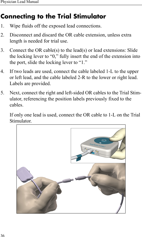 36Physician Lead ManualConnecting to the Trial Stimulator1. Wipe fluids off the exposed lead connections.2. Disconnect and discard the OR cable extension, unless extra length is needed for trial use.3. Connect the OR cable(s) to the lead(s) or lead extensions: Slide the locking lever to “0,” fully insert the end of the extension into the port, slide the locking lever to “1.”4. If two leads are used, connect the cable labeled 1-L to the upper or left lead, and the cable labeled 2-R to the lower or right lead. Labels are provided.5. Next, connect the right and left-sided OR cables to the Trial Stim-ulator, referencing the position labels previously fixed to the cables.If only one lead is used, connect the OR cable to 1-L on the Trial Stimulator.