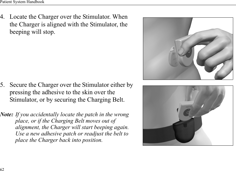Patient System Handbook624. Locate the Charger over the Stimulator. When the Charger is aligned with the Stimulator, the beeping will stop.5. Secure the Charger over the Stimulator either by pressing the adhesive to the skin over the Stimulator, or by securing the Charging Belt.Note: If you accidentally locate the patch in the wrong place, or if the Charging Belt moves out of alignment, the Charger will start beeping again. Use a new adhesive patch or readjust the belt to place the Charger back into position.