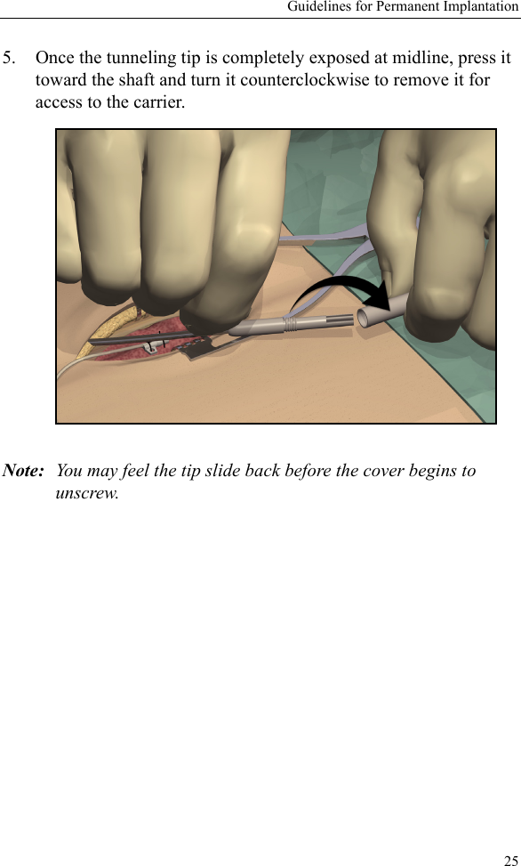 Guidelines for Permanent Implantation255. Once the tunneling tip is completely exposed at midline, press it toward the shaft and turn it counterclockwise to remove it for access to the carrier. Note: You may feel the tip slide back before the cover begins to unscrew. 