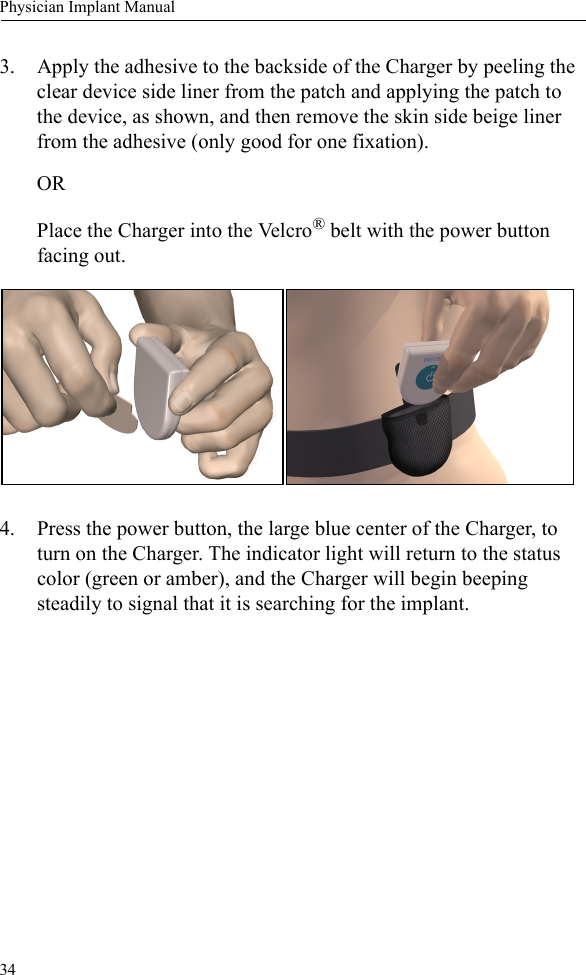 34Physician Implant Manual3. Apply the adhesive to the backside of the Charger by peeling the clear device side liner from the patch and applying the patch to the device, as shown, and then remove the skin side beige liner from the adhesive (only good for one fixation). ORPlace the Charger into the Velcro® belt with the power button facing out. 4. Press the power button, the large blue center of the Charger, to turn on the Charger. The indicator light will return to the status color (green or amber), and the Charger will begin beeping steadily to signal that it is searching for the implant.