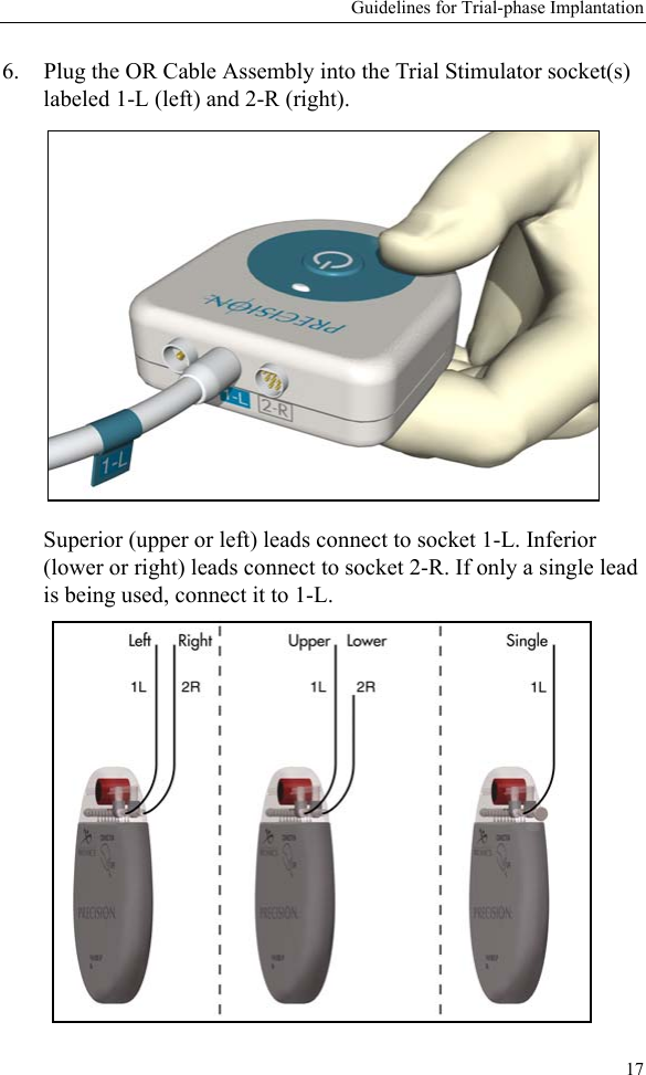 Guidelines for Trial-phase Implantation176. Plug the OR Cable Assembly into the Trial Stimulator socket(s) labeled 1-L (left) and 2-R (right). Superior (upper or left) leads connect to socket 1-L. Inferior (lower or right) leads connect to socket 2-R. If only a single lead is being used, connect it to 1-L. 