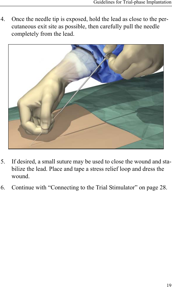 Guidelines for Trial-phase Implantation194. Once the needle tip is exposed, hold the lead as close to the per-cutaneous exit site as possible, then carefully pull the needle completely from the lead.5. If desired, a small suture may be used to close the wound and sta-bilize the lead. Place and tape a stress relief loop and dress the wound.6. Continue with “Connecting to the Trial Stimulator” on page 28.