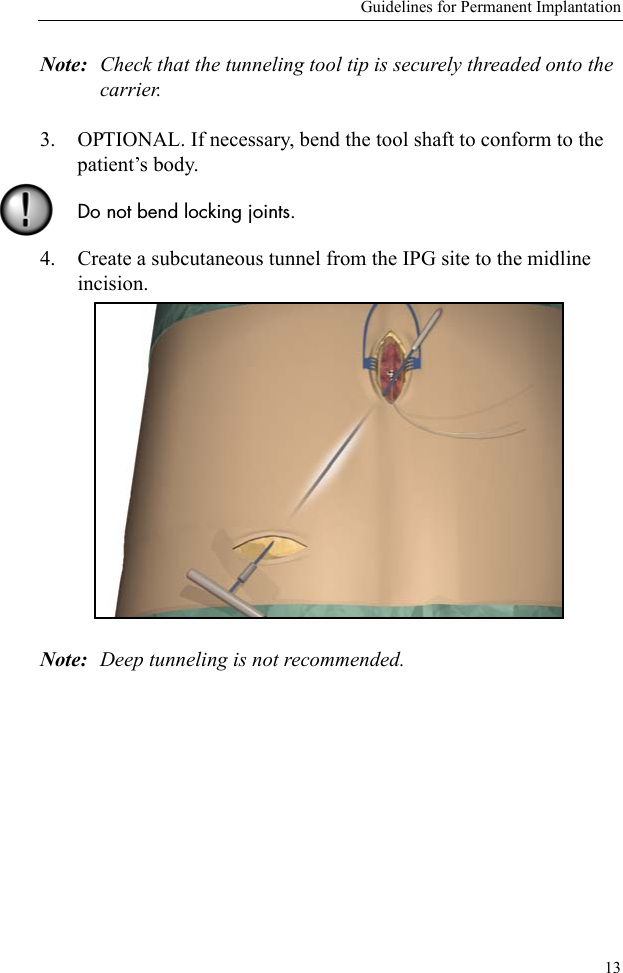 Guidelines for Permanent Implantation13Note: Check that the tunneling tool tip is securely threaded onto the carrier.3. OPTIONAL. If necessary, bend the tool shaft to conform to the patient’s body. Do not bend locking joints. 4. Create a subcutaneous tunnel from the IPG site to the midline incision.Note: Deep tunneling is not recommended.