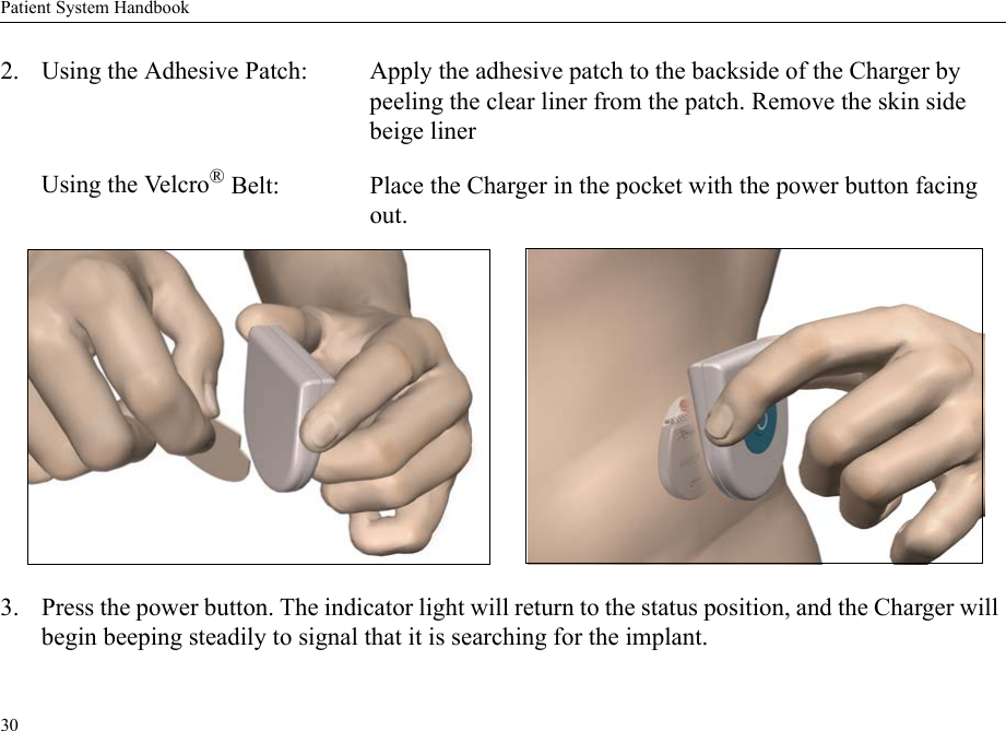 Patient System Handbook302. Using the Adhesive Patch: Apply the adhesive patch to the backside of the Charger by peeling the clear liner from the patch. Remove the skin side beige linerUsing the Velcro® Belt: Place the Charger in the pocket with the power button facing out. 3. Press the power button. The indicator light will return to the status position, and the Charger will begin beeping steadily to signal that it is searching for the implant.