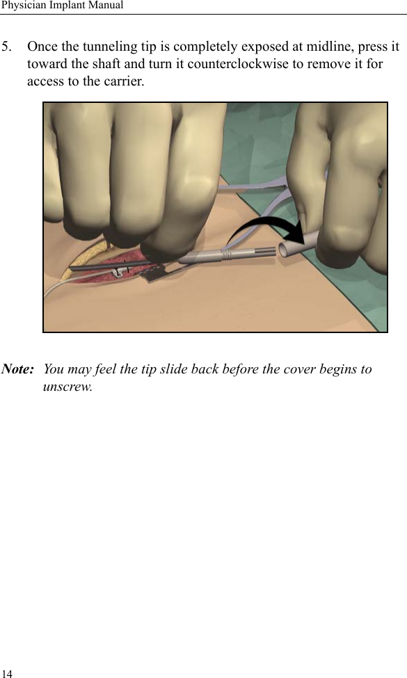 14Physician Implant Manual5. Once the tunneling tip is completely exposed at midline, press it toward the shaft and turn it counterclockwise to remove it for access to the carrier. Note: You may feel the tip slide back before the cover begins to unscrew. 