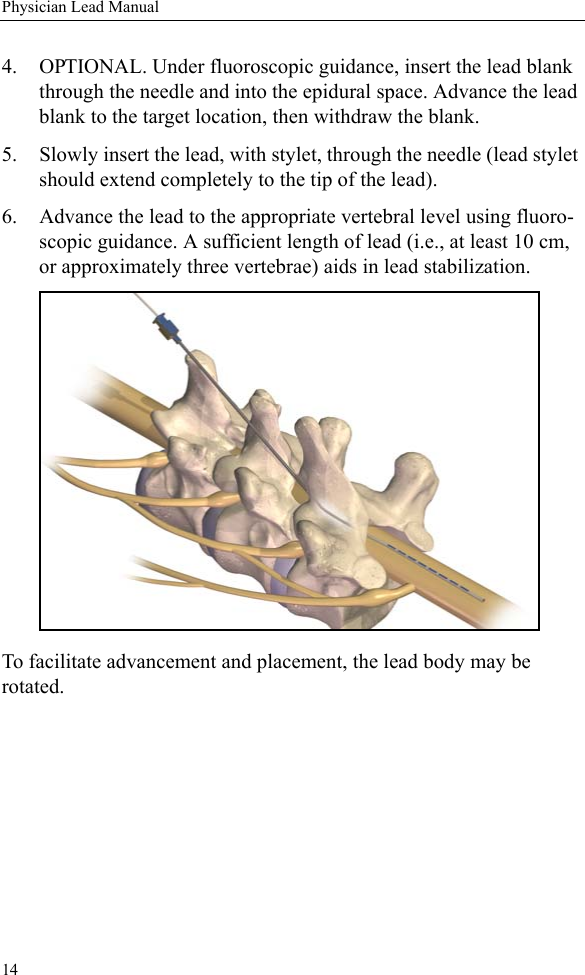 14Physician Lead Manual4. OPTIONAL. Under fluoroscopic guidance, insert the lead blank through the needle and into the epidural space. Advance the lead blank to the target location, then withdraw the blank.5. Slowly insert the lead, with stylet, through the needle (lead stylet should extend completely to the tip of the lead). 6. Advance the lead to the appropriate vertebral level using fluoro-scopic guidance. A sufficient length of lead (i.e., at least 10 cm, or approximately three vertebrae) aids in lead stabilization. To facilitate advancement and placement, the lead body may be rotated.