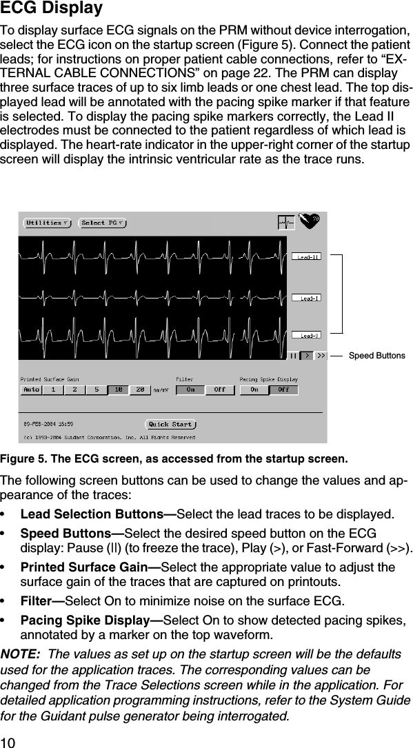10ECG DisplayTo display surface ECG signals on the PRM without device interrogation, select the ECG icon on the startup screen (Figure 5). Connect the patient leads; for instructions on proper patient cable connections, refer to “EX-TERNAL CABLE CONNECTIONS” on page 22. The PRM can display three surface traces of up to six limb leads or one chest lead. The top dis-played lead will be annotated with the pacing spike marker if that feature is selected. To display the pacing spike markers correctly, the Lead II electrodes must be connected to the patient regardless of which lead is displayed. The heart-rate indicator in the upper-right corner of the startup screen will display the intrinsic ventricular rate as the trace runs. Figure 5. The ECG screen, as accessed from the startup screen.The following screen buttons can be used to change the values and ap-pearance of the traces:•Lead Selection Buttons—Select the lead traces to be displayed.•Speed Buttons—Select the desired speed button on the ECG display: Pause (||) (to freeze the trace), Play (&gt;), or Fast-Forward (&gt;&gt;).•Printed Surface Gain—Select the appropriate value to adjust the surface gain of the traces that are captured on printouts.•Filter—Select On to minimize noise on the surface ECG.•Pacing Spike Display—Select On to show detected pacing spikes, annotated by a marker on the top waveform.NOTE:  The values as set up on the startup screen will be the defaults used for the application traces. The corresponding values can be changed from the Trace Selections screen while in the application. For detailed application programming instructions, refer to the System Guide for the Guidant pulse generator being interrogated.Speed Buttons