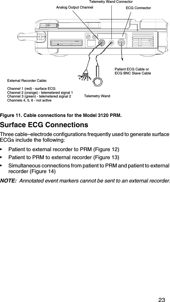 23Figure 11. Cable connections for the Model 3120 PRM.Surface ECG ConnectionsThree cable–electrode configurations frequently used to generate surface ECGs include the following:• Patient to external recorder to PRM (Figure 12)• Patient to PRM to external recorder (Figure 13)• Simultaneous connections from patient to PRM and patient to external recorder (Figure 14)NOTE:  Annotated event markers cannot be sent to an external recorder.Patient ECG Cable orECG BNC Slave CableExternal Recorder Cable:Channel 1 (red) - surface ECGChannel 2 (orange) - telemetered signal 1Channel 3 (green) - telemetered signal 2Channels 4, 5, 6 - not activeTelemetry Wand ConnectorAnalog Output Channel ECG ConnectorTelemetry Wand 