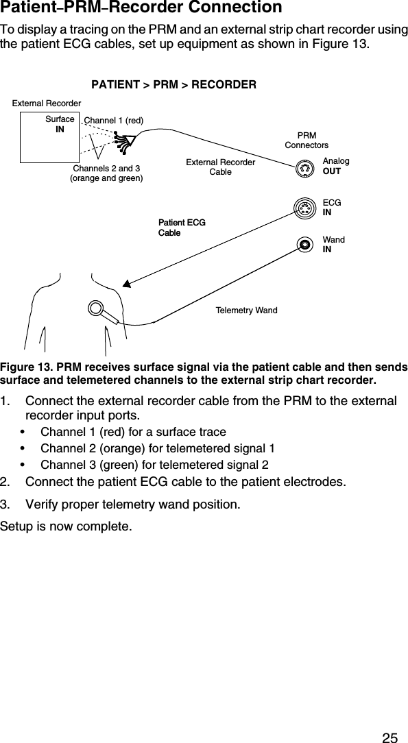 25Patient–PRM–Recorder ConnectionTo display a tracing on the PRM and an external strip chart recorder using the patient ECG cables, set up equipment as shown in Figure 13.Figure 13. PRM receives surface signal via the patient cable and then sends surface and telemetered channels to the external strip chart recorder.1. Connect the external recorder cable from the PRM to the external recorder input ports.• Channel 1 (red) for a surface trace• Channel 2 (orange) for telemetered signal 1• Channel 3 (green) for telemetered signal 22. Connect the patient ECG cable to the patient electrodes.3. Verify proper telemetry wand position.Setup is now complete.Telemetry WandPatient ECG CableExternal RecorderExternal Recorder CablePATIENT &gt; PRM &gt; RECORDERChannel 1 (red)PRMConnectorsECGINWandINAnalogOUTSurface INChannels 2 and 3 (orange and green)Patient ECG Cable
