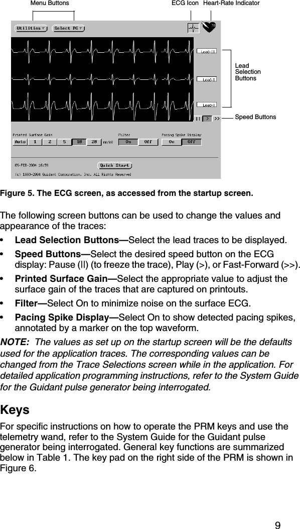 9The following screen buttons can be used to change the values and appearance of the traces:•Lead Selection Buttons—Select the lead traces to be displayed.•Speed Buttons—Select the desired speed button on the ECG display: Pause (||) (to freeze the trace), Play (&gt;), or Fast-Forward (&gt;&gt;).•Printed Surface Gain—Select the appropriate value to adjust the surface gain of the traces that are captured on printouts.•Filter—Select On to minimize noise on the surface ECG.•Pacing Spike Display—Select On to show detected pacing spikes, annotated by a marker on the top waveform.NOTE:  The values as set up on the startup screen will be the defaults used for the application traces. The corresponding values can be changed from the Trace Selections screen while in the application. For detailed application programming instructions, refer to the System Guide for the Guidant pulse generator being interrogated.KeysFor specific instructions on how to operate the PRM keys and use the telemetry wand, refer to the System Guide for the Guidant pulse generator being interrogated. General key functions are summarized below in Table 1. The key pad on the right side of the PRM is shown in Figure 6.Figure 5. The ECG screen, as accessed from the startup screen.Speed ButtonsLead Selection ButtonsHeart-Rate IndicatorMenu Buttons             ECG Icon
