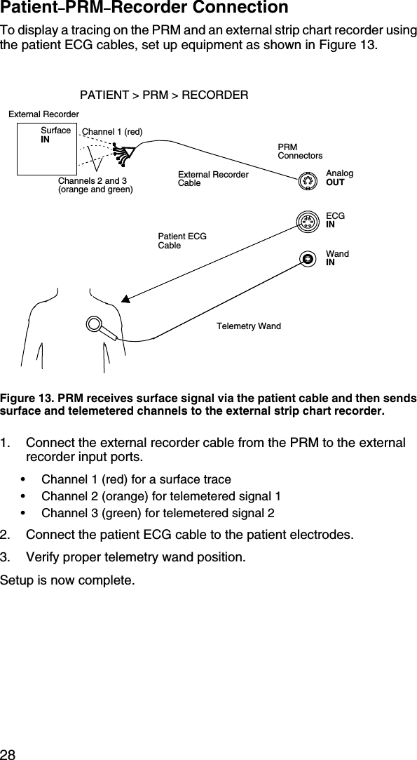 28Patient–PRM–Recorder ConnectionTo display a tracing on the PRM and an external strip chart recorder using the patient ECG cables, set up equipment as shown in Figure 13.1. Connect the external recorder cable from the PRM to the external recorder input ports.• Channel 1 (red) for a surface trace• Channel 2 (orange) for telemetered signal 1• Channel 3 (green) for telemetered signal 22. Connect the patient ECG cable to the patient electrodes.3. Verify proper telemetry wand position.Setup is now complete.Figure 13. PRM receives surface signal via the patient cable and then sends surface and telemetered channels to the external strip chart recorder.Telemetry WandPatient ECG CableExternal RecorderExternal Recorder CablePATIENT &gt; PRM &gt; RECORDERChannel 1 (red)PRMConnectorsECGINWandINAnalogOUTSurface INChannels 2 and 3 (orange and green)