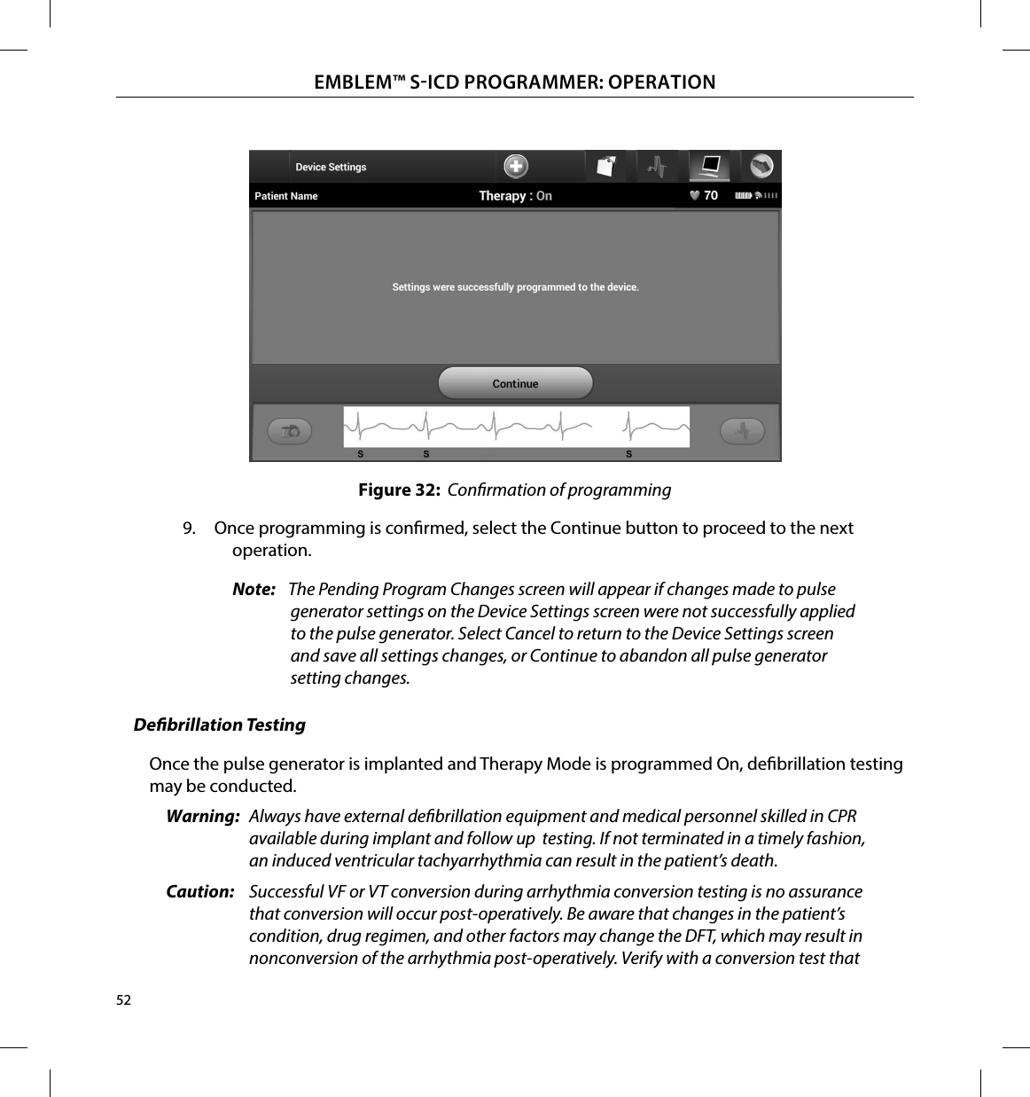 52EMBLEM™ SICD PROGRAMMER: OPERATIONFigure 32:  Conrmation of programming9.  Once programming is conrmed, select the Continue button to proceed to the next operation.Note:   The Pending Program Changes screen will appear if changes made to pulse generator settings on the Device Settings screen were not successfully applied to the pulse generator. Select Cancel to return to the Device Settings screen and save all settings changes, or Continue to abandon all pulse generator setting changes.Debrillation TestingOnce the pulse generator is implanted and Therapy Mode is programmed On, debrillation testing may be conducted.Warning:  Always have external debrillation equipment and medical personnel skilled in CPR available during implant and follow up  testing. If not terminated in a timely fashion, an induced ventricular tachyarrhythmia can result in the patient’s death.Caution:  Successful VF or VT conversion during arrhythmia conversion testing is no assurance that conversion will occur post-operatively. Be aware that changes in the patient’s condition, drug regimen, and other factors may change the DFT, which may result in nonconversion of the arrhythmia post-operatively. Verify with a conversion test that 