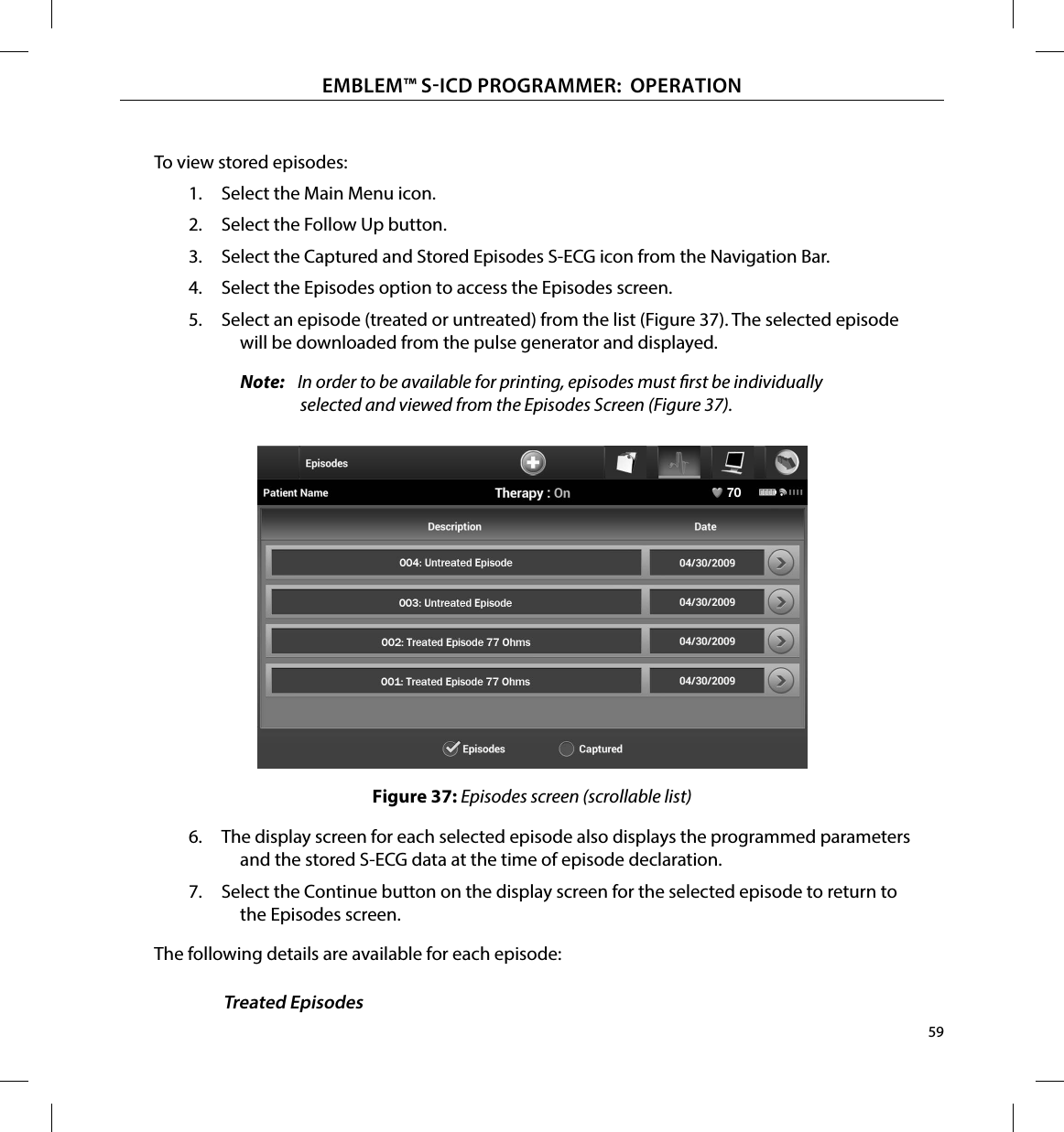 59EMBLEM™ SICD PROGRAMMER:  OPERATIONTo view stored episodes:1.  Select the Main Menu icon.2.  Select the Follow Up button.3.  Select the Captured and Stored Episodes S-ECG icon from the Navigation Bar.4.  Select the Episodes option to access the Episodes screen.5.  Select an episode (treated or untreated) from the list (Figure 37). The selected episode will be downloaded from the pulse generator and displayed.Note:   In order to be available for printing, episodes must rst be individually selected and viewed from the Episodes Screen (Figure 37).Figure 37: Episodes screen (scrollable list)6.  The display screen for each selected episode also displays the programmed parameters and the stored S-ECG data at the time of episode declaration.7.  Select the Continue button on the display screen for the selected episode to return to the Episodes screen.The following details are available for each episode:Treated Episodes