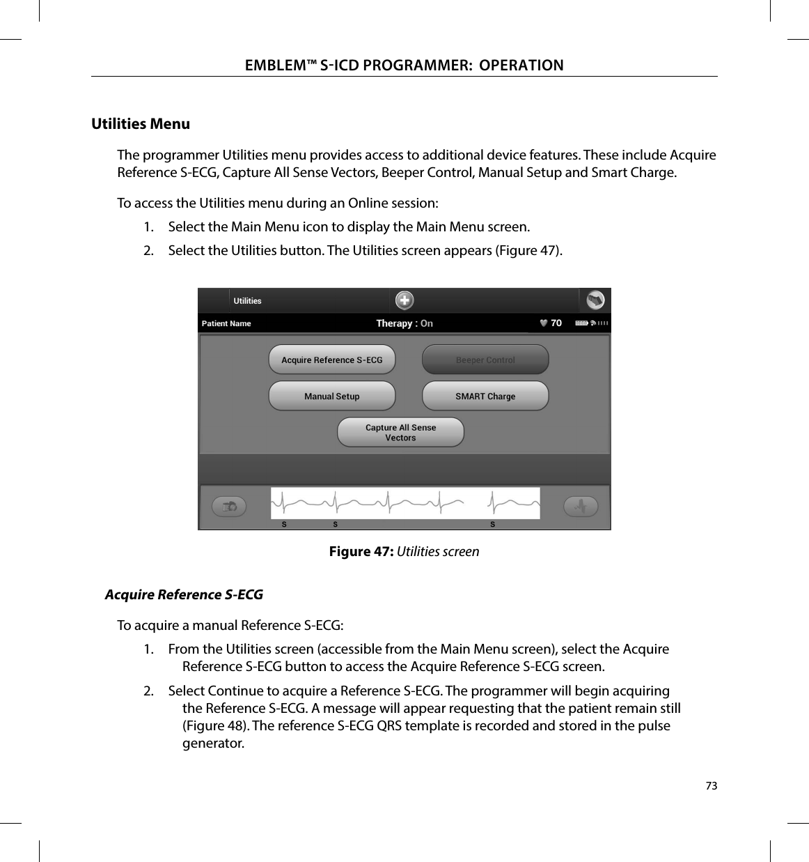 73EMBLEM™ SICD PROGRAMMER:  OPERATIONUtilities MenuThe programmer Utilities menu provides access to additional device features. These include Acquire Reference S-ECG, Capture All Sense Vectors, Beeper Control, Manual Setup and Smart Charge.To access the Utilities menu during an Online session:1.  Select the Main Menu icon to display the Main Menu screen.2.  Select the Utilities button. The Utilities screen appears (Figure 47).Figure 47: Utilities screenAcquire Reference S-ECGTo acquire a manual Reference S-ECG:1.  From the Utilities screen (accessible from the Main Menu screen), select the Acquire Reference S-ECG button to access the Acquire Reference S-ECG screen.2.  Select Continue to acquire a Reference S-ECG. The programmer will begin acquiring the Reference S-ECG. A message will appear requesting that the patient remain still (Figure 48). The reference S-ECG QRS template is recorded and stored in the pulse generator.