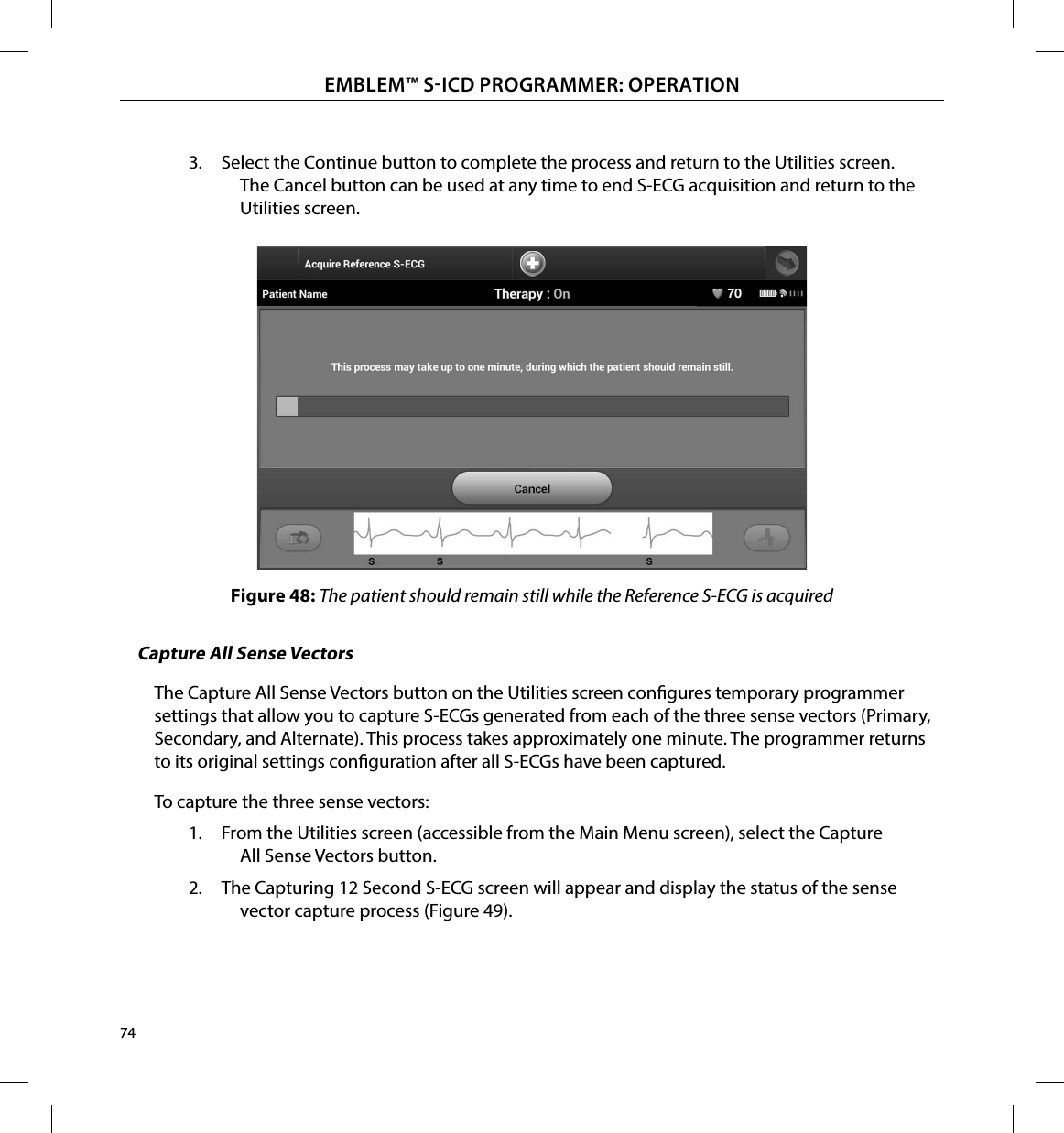 74EMBLEM™ SICD PROGRAMMER: OPERATION3.  Select the Continue button to complete the process and return to the Utilities screen. The Cancel button can be used at any time to end S-ECG acquisition and return to the Utilities screen.Figure 48: The patient should remain still while the Reference S-ECG is acquiredCapture All Sense VectorsThe Capture All Sense Vectors button on the Utilities screen congures temporary programmer settings that allow you to capture S-ECGs generated from each of the three sense vectors (Primary, Secondary, and Alternate). This process takes approximately one minute. The programmer returns to its original settings conguration after all S-ECGs have been captured.To capture the three sense vectors:1.  From the Utilities screen (accessible from the Main Menu screen), select the Capture All Sense Vectors button.2.  The Capturing 12 Second S-ECG screen will appear and display the status of the sense vector capture process (Figure 49).