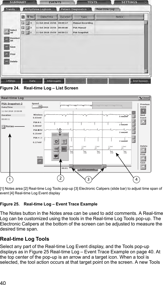 40Figure 24. Real-time Log – List Screen[1] Notes area [2] Real-time Log Tools pop-up [3] Electronic Calipers (slide bar) to adjust time span ofevent [4] Real-time Log Event displayFigure 25. Real-time Log – Event Trace ExampleThe Notes button in the Notes area can be used to add comments. A Real-timeLog can be customized using the tools in the Real-time Log Tools pop-up. TheElectronic Calipers at the bottom of the screen can be adjusted to measure thedesired time span.Real-time Log ToolsSelect any part of the Real-time Log Event display, and the Tools pop-updisplays as in Figure 25 Real-time Log – Event Trace Example on page 40. Atthe top center of the pop-up is an arrow and a target icon. When a tool isselected, the tool action occurs at that target point on the screen. A new Tools