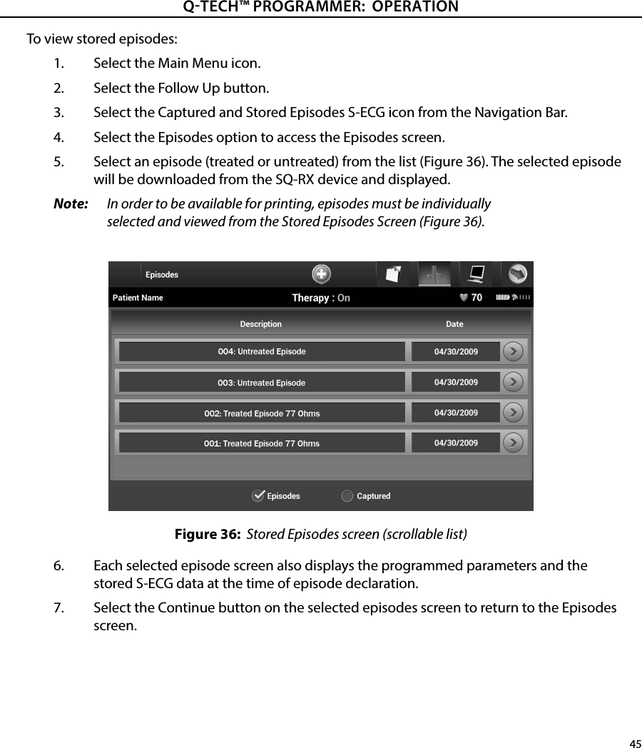 45QTECH™ PROGRAMMER:  OPERATIONTo view stored episodes:1.  Select the Main Menu icon.2.  Select the Follow Up button.3.  Select the Captured and Stored Episodes S-ECG icon from the Navigation Bar.4.  Select the Episodes option to access the Episodes screen.5.  Select an episode (treated or untreated) from the list (Figure 36). The selected episode will be downloaded from the SQ-RX device and displayed.Note:   In order to be available for printing, episodes must be individually selected and viewed from the Stored Episodes Screen (Figure 36).Figure 36:  Stored Episodes screen (scrollable list)6.  Each selected episode screen also displays the programmed parameters and the stored S-ECG data at the time of episode declaration.7.  Select the Continue button on the selected episodes screen to return to the Episodes screen.