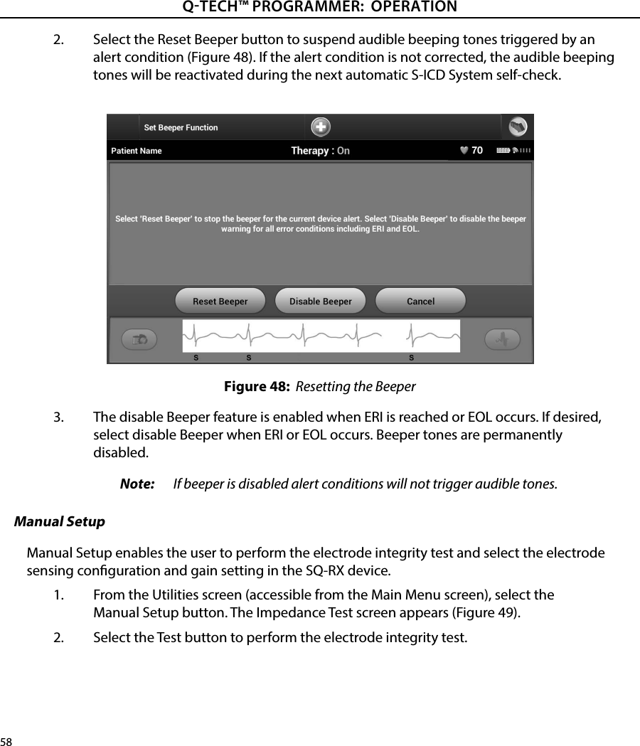 58QTECH™ PROGRAMMER:  OPERATION2.  Select the Reset Beeper button to suspend audible beeping tones triggered by an alert condition (Figure 48). If the alert condition is not corrected, the audible beeping tones will be reactivated during the next automatic S-ICD System self-check.Figure 48:  Resetting the Beeper3.  The disable Beeper feature is enabled when ERI is reached or EOL occurs. If desired, select disable Beeper when ERI or EOL occurs. Beeper tones are permanently disabled.Note:   If beeper is disabled alert conditions will not trigger audible tones.Manual SetupManual Setup enables the user to perform the electrode integrity test and select the electrode sensing conguration and gain setting in the SQ-RX device.1.  From the Utilities screen (accessible from the Main Menu screen), select the Manual Setup button. The Impedance Test screen appears (Figure 49).2.  Select the Test button to perform the electrode integrity test.
