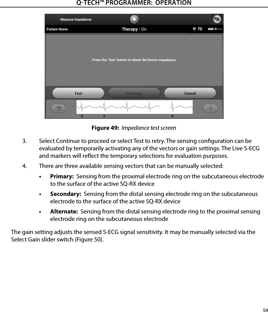 59QTECH™ PROGRAMMER:  OPERATIONFigure 49:  Impedance test screen3.  Select Continue to proceed or select Test to retry. The sensing conguration can be evaluated by temporarily activating any of the vectors or gain settings. The Live S-ECG and markers will reect the temporary selections for evaluation purposes.4.  There are three available sensing vectors that can be manually selected:•  Primary:  Sensing from the proximal electrode ring on the subcutaneous electrode to the surface of the active SQ-RX device•  Secondary:  Sensing from the distal sensing electrode ring on the subcutaneous electrode to the surface of the active SQ-RX device•  Alternate:  Sensing from the distal sensing electrode ring to the proximal sensing electrode ring on the subcutaneous electrodeThe gain setting adjusts the sensed S-ECG signal sensitivity. It may be manually selected via the Select Gain slider switch (Figure 50).