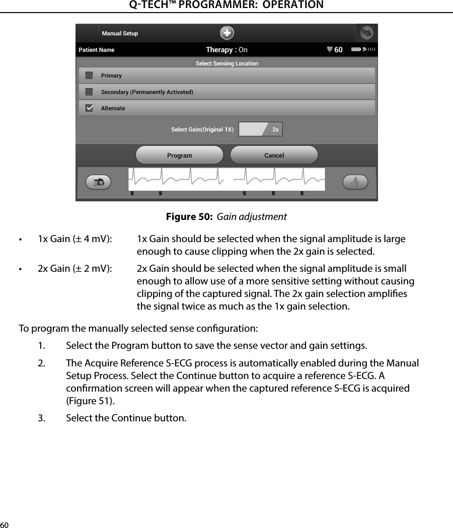 60QTECH™ PROGRAMMER:  OPERATIONFigure 50:  Gain adjustment•  1x Gain (± 4 mV):  1x Gain should be selected when the signal amplitude is large enough to cause clipping when the 2x gain is selected.•  2x Gain (± 2 mV):  2x Gain should be selected when the signal amplitude is small enough to allow use of a more sensitive setting without causing clipping of the captured signal. The 2x gain selection amplies the signal twice as much as the 1x gain selection.To program the manually selected sense conguration:1.  Select the Program button to save the sense vector and gain settings.2.  The Acquire Reference S-ECG process is automatically enabled during the Manual Setup Process. Select the Continue button to acquire a reference S-ECG. A conrmation screen will appear when the captured reference S-ECG is acquired (Figure 51).3.  Select the Continue button.