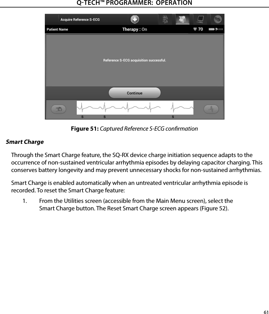61QTECH™ PROGRAMMER:  OPERATIONFigure 51: Captured Reference S-ECG conrmationSmart ChargeThrough the Smart Charge feature, the SQ-RX device charge initiation sequence adapts to the occurrence of non-sustained ventricular arrhythmia episodes by delaying capacitor charging. This conserves battery longevity and may prevent unnecessary shocks for non-sustained arrhythmias.Smart Charge is enabled automatically when an untreated ventricular arrhythmia episode is recorded. To reset the Smart Charge feature:1.  From the Utilities screen (accessible from the Main Menu screen), select the Smart Charge button. The Reset Smart Charge screen appears (Figure 52).