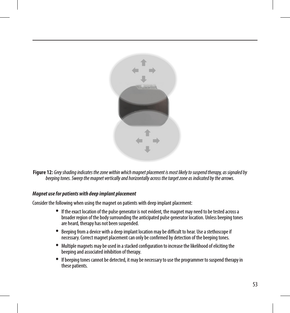 53Figure 12: Grey shading indicates the zone within which magnet placement is most likely to suspend therapy, as signaled by beeping tones. Sweep the magnet vertically and horizontally across the target zone as indicated by the arrows. Magnet use for patients with deep implant placementConsider the following when using the magnet on patients with deep implant placement:•  If the exact location of the pulse generator is not evident, the magnet may need to be tested across a broader region of the body surrounding the anticipated pulse generator location. Unless beeping tones are heard, therapy has not been suspended.•  Beeping from a device with a deep implant location may be dicult to hear. Use a stethoscope if necessary. Correct magnet placement can only be conrmed by detection of the beeping tones.•  Multiple magnets may be used in a stacked conguration to increase the likelihood of eliciting the beeping and associated inhibition of therapy.•  If beeping tones cannot be detected, it may be necessary to use the programmer to suspend therapy in these patients.