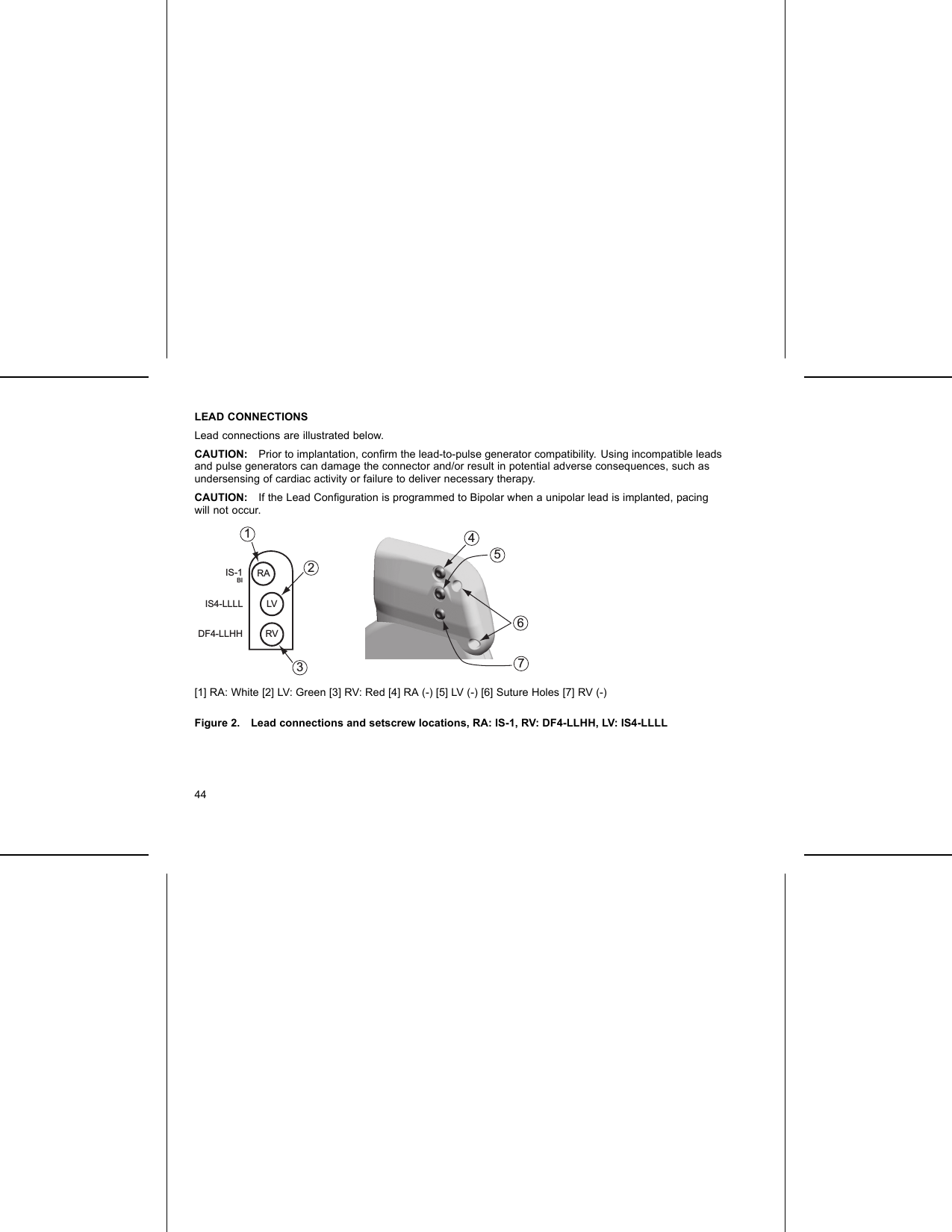 LEAD CONNECTIONSLead connections are illustrated below.CAUTION: Prior to implantation, conﬁrm the lead-to-pulse generator compatibility. Using incompatible leadsand pulse generators can damage the connector and/or result in potential adverse consequences, such asundersensing of cardiac activity or failure to deliver necessary therapy.CAUTION: If the Lead Conﬁguration is programmed to Bipolar when a unipolar lead is implanted, pacingwill not occur.6457IS-1 BIDF4-LLHH RVRAIS4-LLLL LV321[1] RA: White [2] LV: Green [3] RV: Red [4] RA (-) [5] LV (-) [6] Suture Holes [7] RV (-)Figure 2. Lead connections and setscrew locations, RA: IS-1, RV: DF4-LLHH, LV: IS4-LLLL44