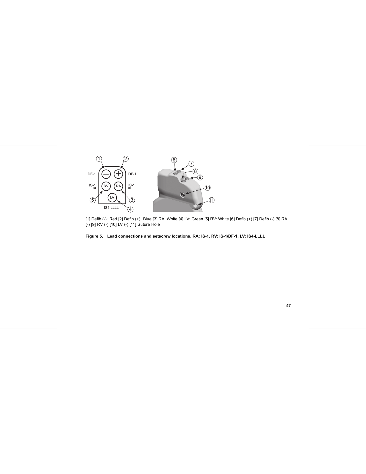 11671089IS-1 BIIS4-LLLLLVRV–+RADF-1DF-1IS-1 BI1 2345[1] Deﬁb (-): Red [2] Deﬁb (+): Blue [3] RA: White [4] LV: Green [5] RV: White [6] Deﬁb(+)[7]Deﬁb (-) [8] RA(-) [9] RV (-) [10] LV (-) [11] Suture HoleFigure 5. Lead connections and setscrew locations, RA: IS-1, RV: IS-1/DF-1, LV: IS4-LLLL47