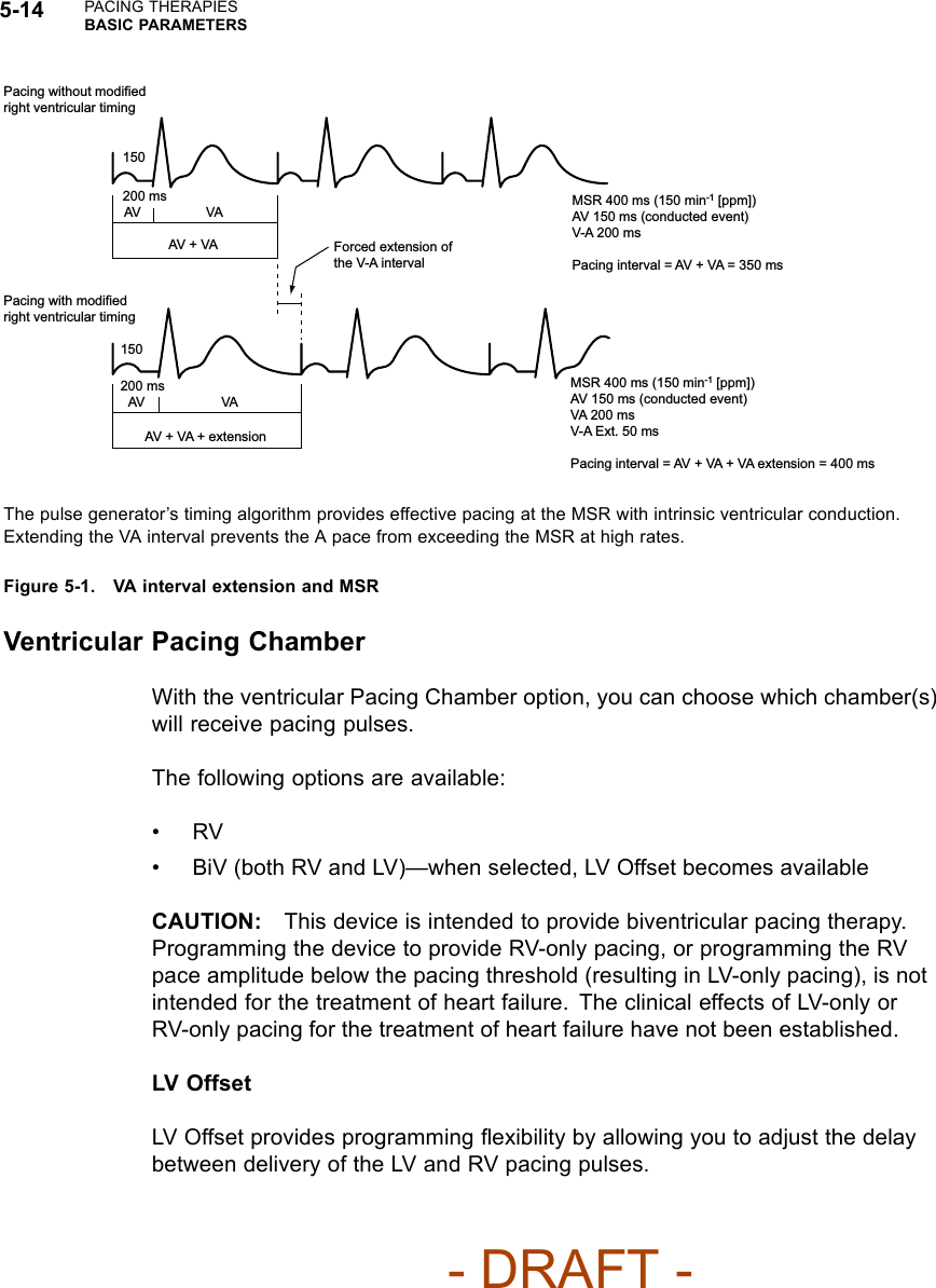 5-14 PACING THERAPIESBASIC PARAMETERSPacing without modified right ventricular timing Pacing with modified right ventricular timing 150 200 ms AV  VA AV + VA  Forced extension of the V-A interval 150 200 ms AV  VA AV + VA + extension MSR 400 ms (150 min-1 [ppm])AV 150 ms (conducted event)V-A 200 msPacing interval = AV + VA = 350 msMSR 400 ms (150 min-1 [ppm])AV 150 ms (conducted event)VA 200 msV-A Ext. 50 msPacing interval = AV + VA + VA extension = 400 msThe pulse generator’s timing algorithm provides effective pacing at the MSR with intrinsic ventricular conduction.Extending the VA interval prevents the A pace from exceeding the MSR at high rates.Figure 5-1. VA interval extension and MSRVentricular Pacing ChamberWith the ventricular Pacing Chamber option, you can choose which chamber(s)will receive pacing pulses.The following options are available:•RV• BiV (both RV and LV)—when selected, LV Offset becomes availableCAUTION: This device is intended to provide biventricular pacing therapy.Programming the device to provide RV-only pacing, or programming the RVpace amplitude below the pacing threshold (resulting in LV-only pacing), is notintended for the treatment of heart failure. The clinical effects of LV-only orRV-only pacing for the treatment of heart failure have not been established.LV OffsetLV Offset provides programming ﬂexibility by allowing you to adjust the delaybetween delivery of the LV and RV pacing pulses.- DRAFT -