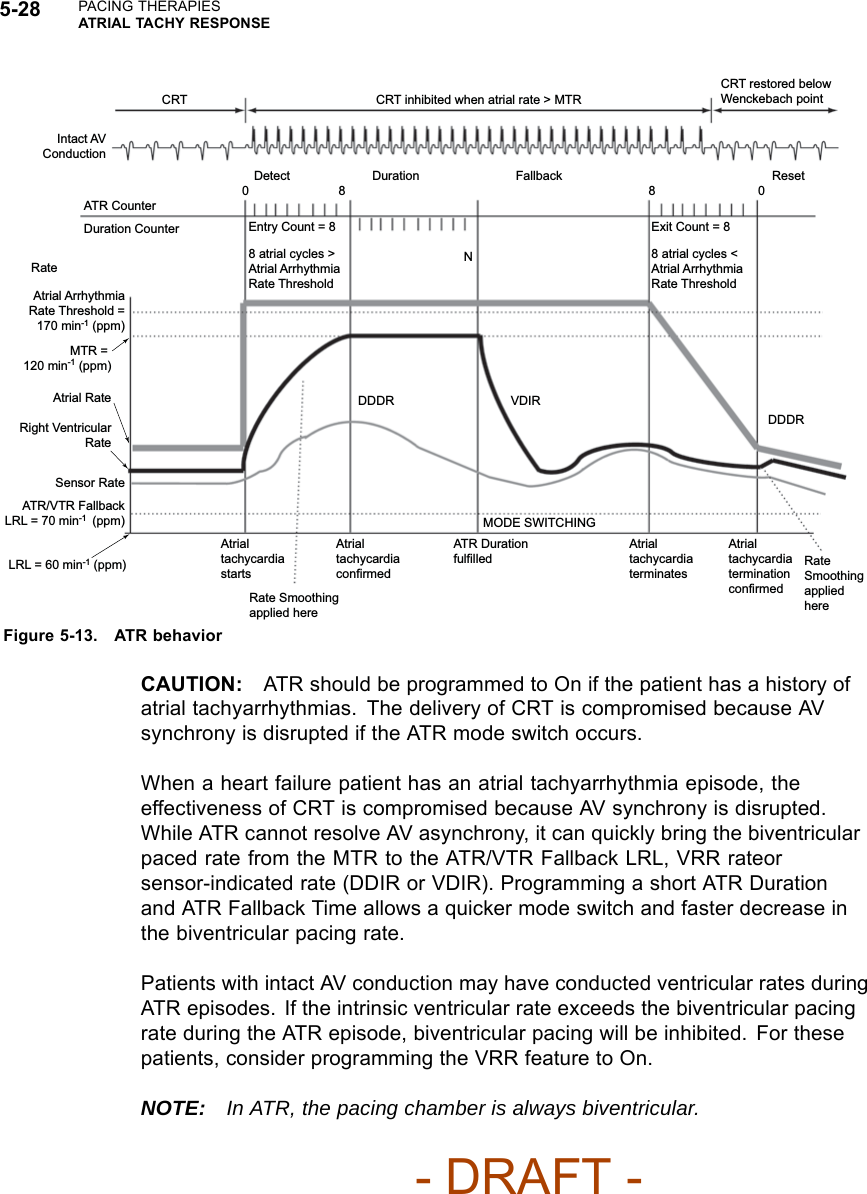 5-28 PACING THERAPIESATRIAL TACHY RESPONSECRT  CRT inhibited when atrial rate &gt; MTR CRT restored below Wenckebach point Intact AV Conduction ATR Counter Duration Counter 0 8 Detect Duration  Fallback  Reset 0 8 Exit Count = 8 8 atrial cycles &lt; Atrial Arrhythmia Rate Threshold N Entry Count = 8 8 atrial cycles &gt; Atrial Arrhythmia Rate Threshold Atrial Arrhythmia Rate Threshold = 170 min-1 (ppm)MTR = 120 min-1 (ppm)RateAtrial RateRight Ventricular RateSensor Rate ATR/VTR Fallback LRL = 70 min-1  (ppm)LRL = 60 min-1 (ppm)Atrial tachycardia starts Rate Smoothing applied here Atrial tachycardia confirmed ATR Duration fulfilled Atrial tachycardia terminates Atrial tachycardia termination confirmed Rate Smoothing applied here MODE SWITCHING DDDR VDIR DDDR Figure 5-13. ATR behaviorCAUTION: ATR should be programmed to On if the patient has a history ofatrial tachyarrhythmias. The delivery of CRT is compromised because AVsynchrony is disrupted if the ATR mode switch occurs.When a heart failure patient has an atrial tachyarrhythmia episode, theeffectiveness of CRT is compromised because AV synchrony is disrupted.While ATR cannot resolve AV asynchrony, it can quickly bring the biventricularpaced rate from the MTR to the ATR/VTR Fallback LRL, VRR rateorsensor-indicated rate (DDIR or VDIR). Programming a short ATR Durationand ATR Fallback Time allows a quicker mode switch and faster decrease inthe biventricular pacing rate.Patients with intact AV conduction may have conducted ventricular rates duringATR episodes. If the intrinsic ventricular rate exceeds the biventricular pacingrate during the ATR episode, biventricular pacing will be inhibited. For thesepatients, consider programming the VRR feature to On.NOTE: In ATR, the pacing chamber is always biventricular.- DRAFT -