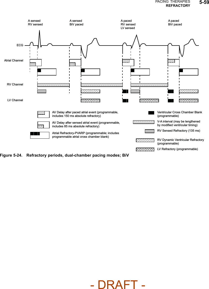 PACING THERAPIESREFRACTORY 5-59AV Delay after paced atrial event (programmable, includes 150 ms absolute refractory) AV Delay after sensed atrial event (programmable, includes 85 ms absolute refractory) Atrial Refractory-PVARP (programmable; includes programmable atrial cross chamber blank) V-A interval (may be lengthened by modified ventricular timing) RV Sensed Refractory (135 ms) RV Dynamic Ventricular Refractory (programmable) Ventricular Cross Chamber Blank (programmable) LV Refractory (programmable) A sensed RV sensed A sensed BiV paced A paced RV sensed LV sensed A paced BiV paced ECG Atrial Channel RV Channel LV Channel Figure 5-24. Refractory periods, dual-chamber pacing modes; BiV- DRAFT -