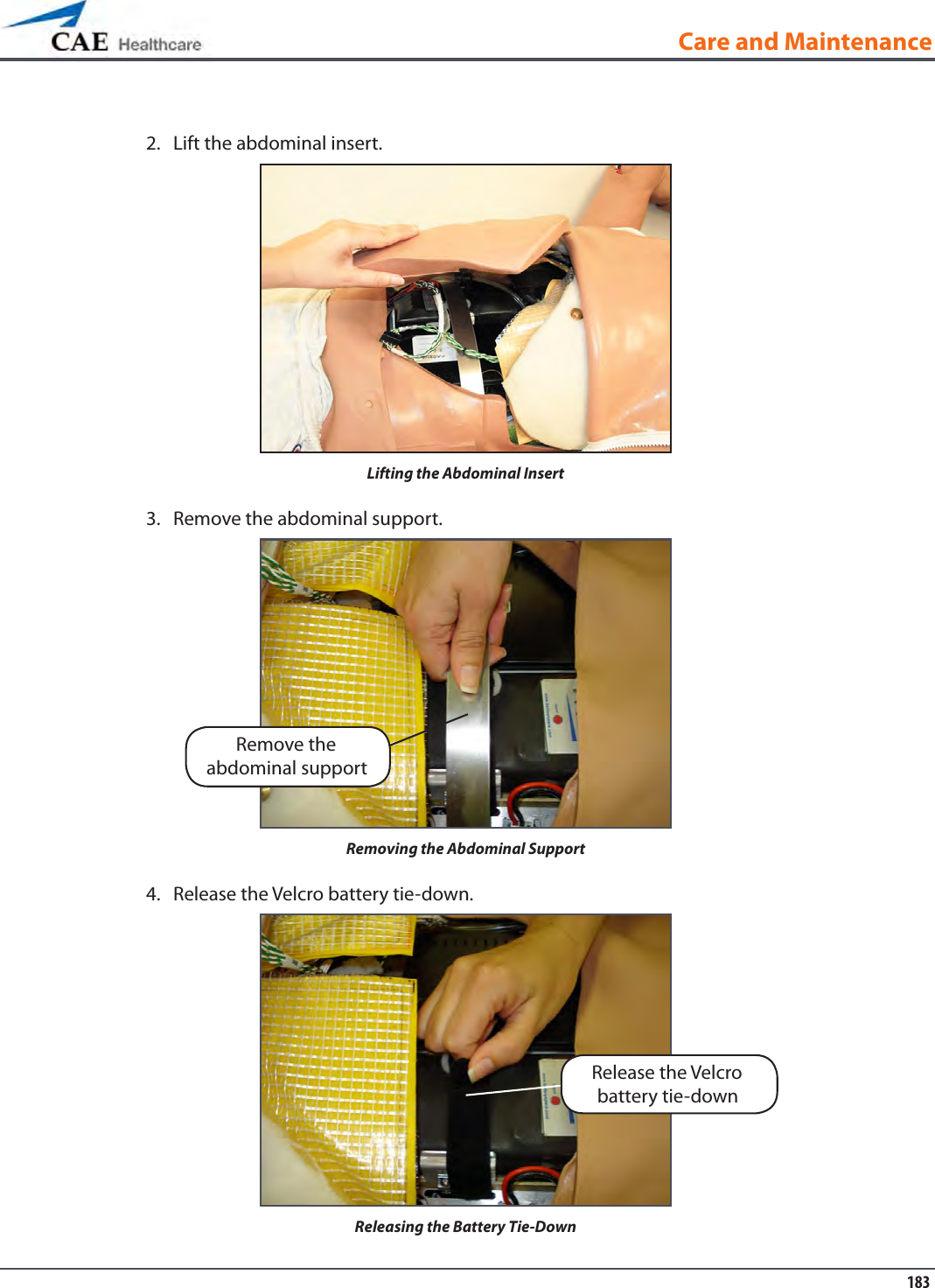 183Care and MaintenanceLift the abdominal insert.2. Lifting the Abdominal InsertRemove the abdominal support.3. Removing the Abdominal SupportRelease the Velcro battery tie-down.4. Releasing the Battery Tie-Down Remove the abdominal supportRelease the Velcro battery tie-down